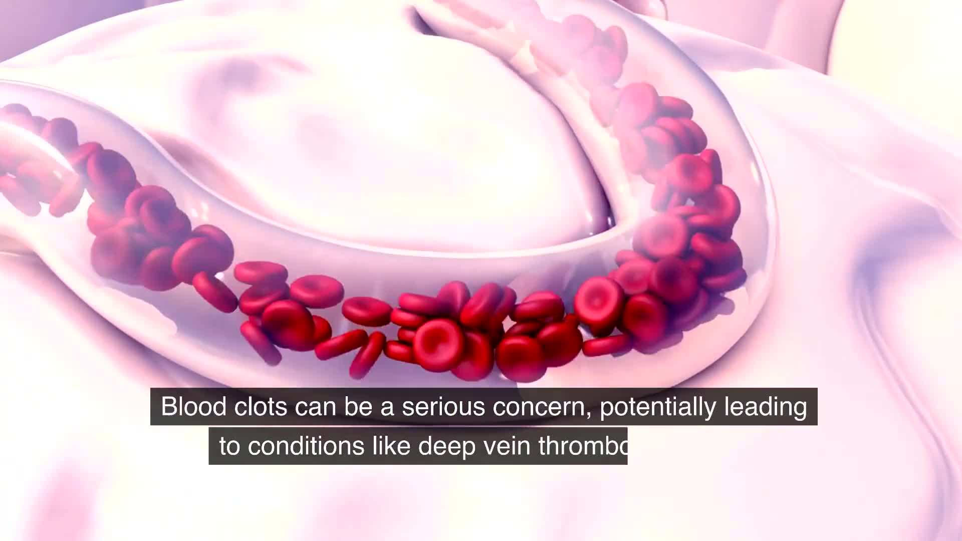 Blood clot formation