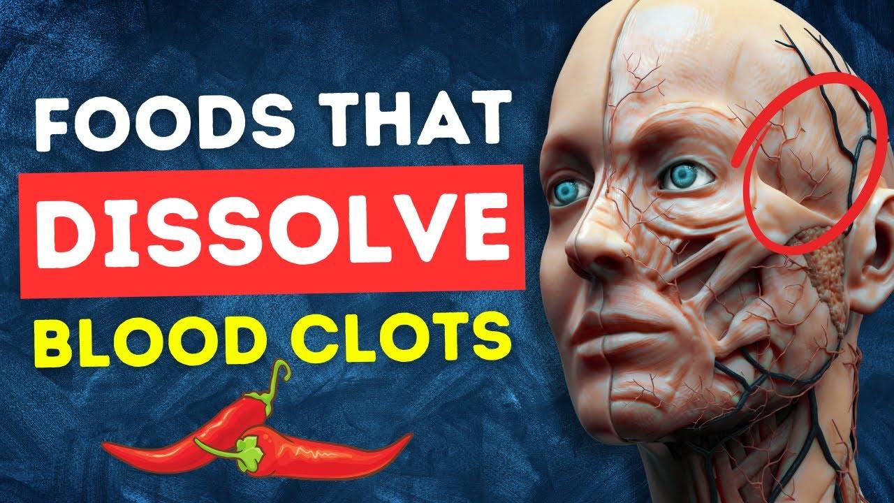 14 Foods That Dissolve Blood Clots Naturally - Natural Cures