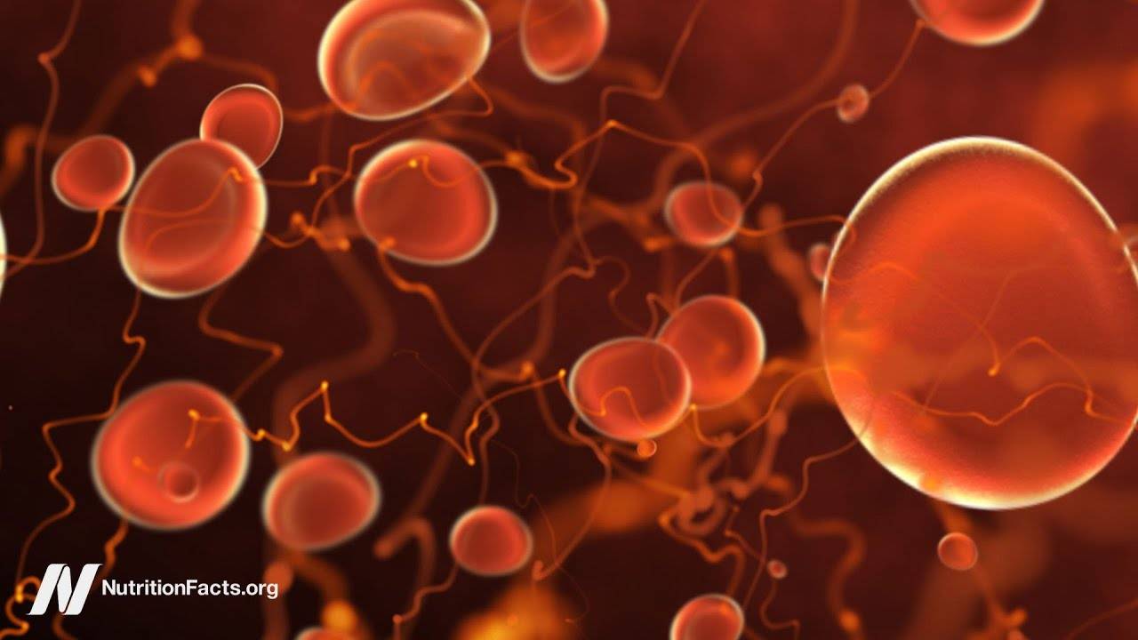 Targeting Angiogenesis: Foods That Help You Lose Weight and Prevent Tumors