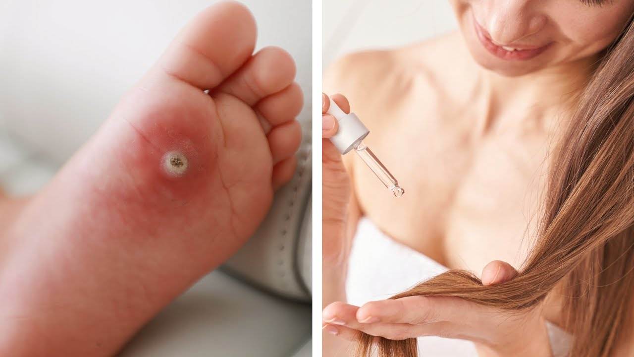 The Power of Castor Oil: Surprising Health Benefits Revealed