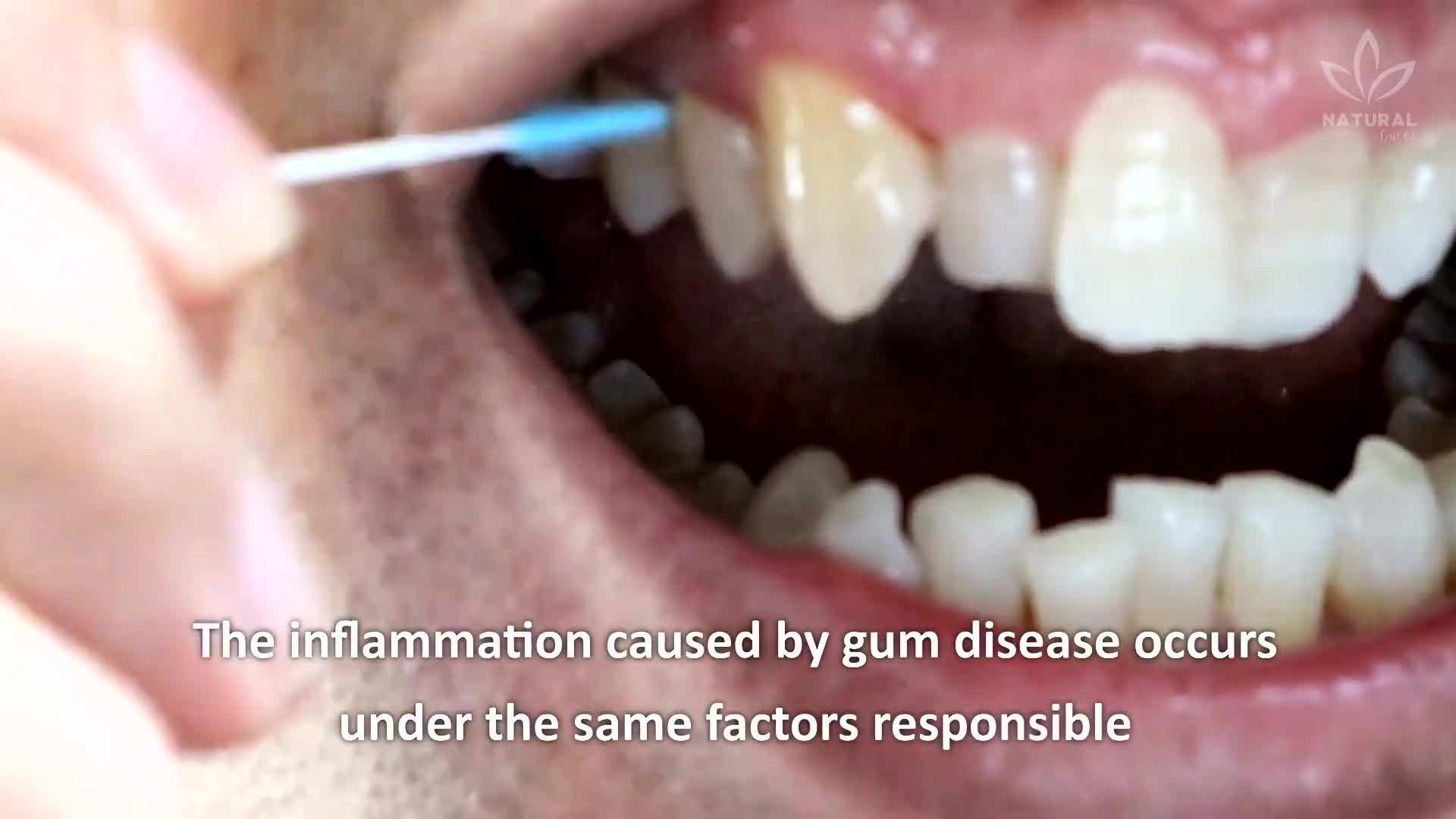 Ahealthy diet is crucial for managing diabetes