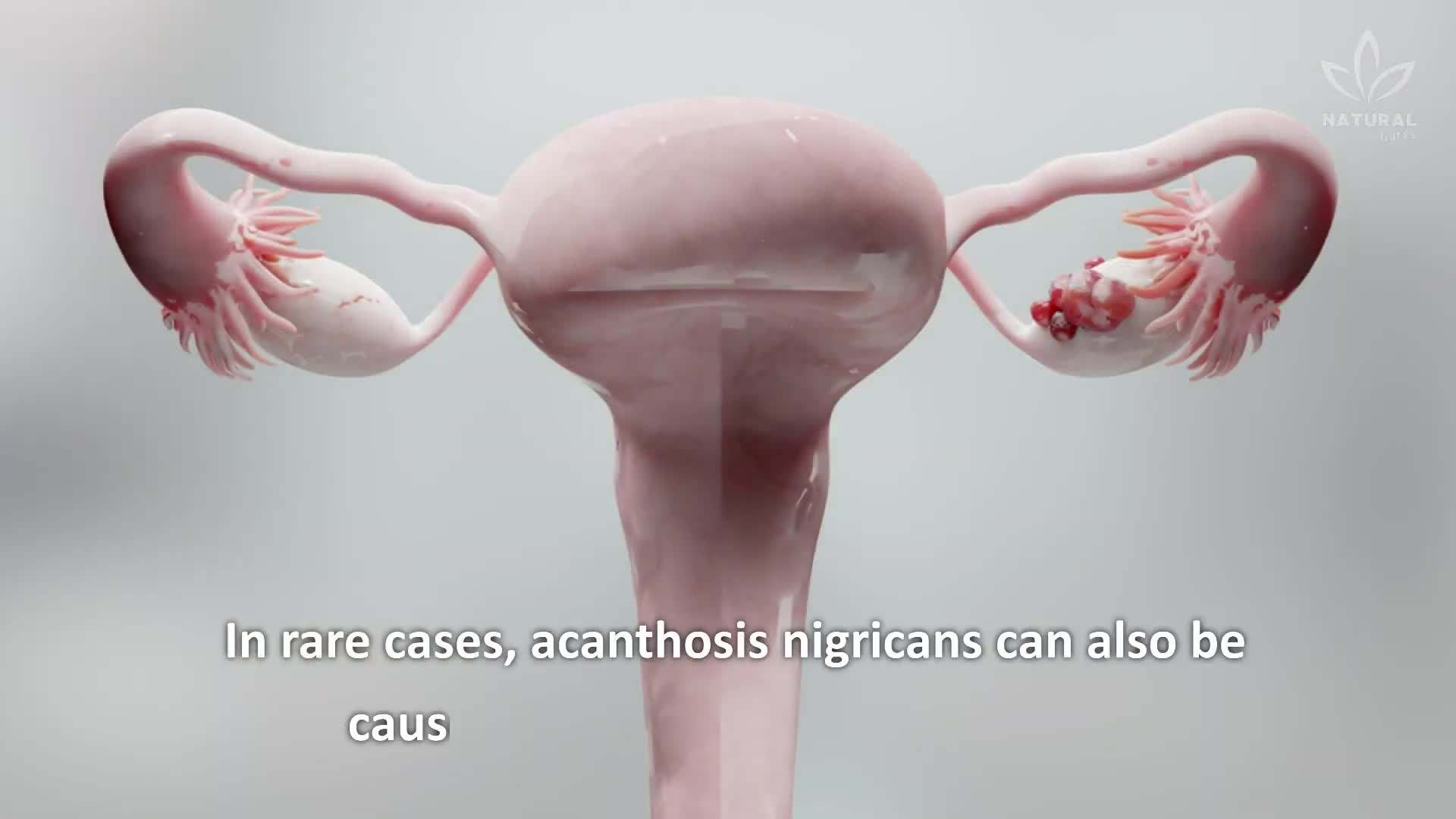 Regular exercise is beneficial for diabetes management