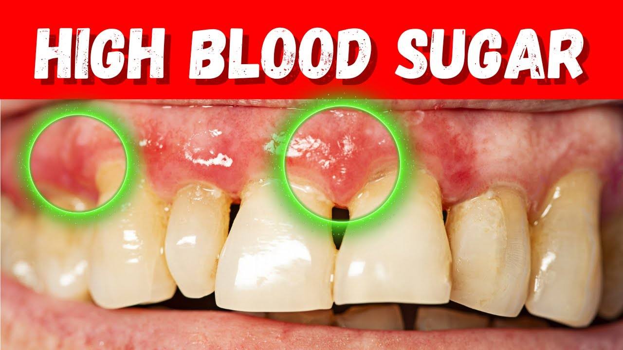 EVEN DOCTORS MISS THESE EARLY SIGNS OF DIABETES - Natural Cures