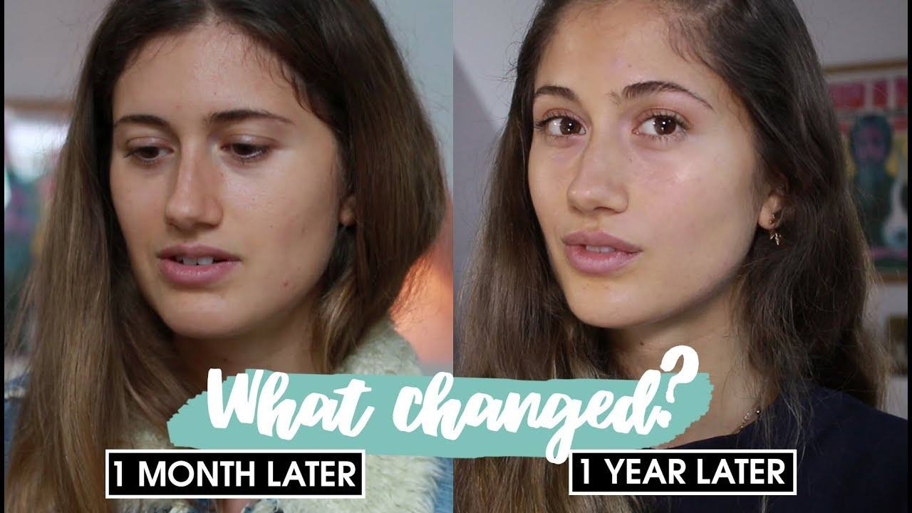 No Makeup Challenge: 1 Year Later - The Impact on My Skin and Lifestyle