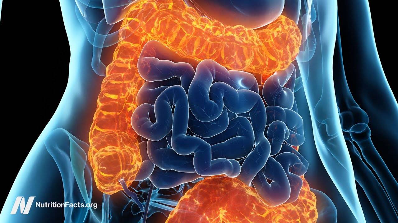 Fecal Transplants: A Revolutionary Treatment for Ulcerative Colitis and More