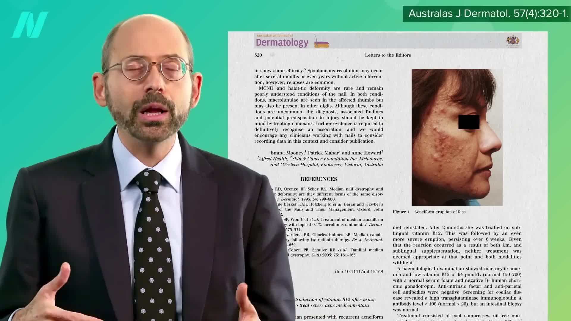 Image depicting a fractured bone