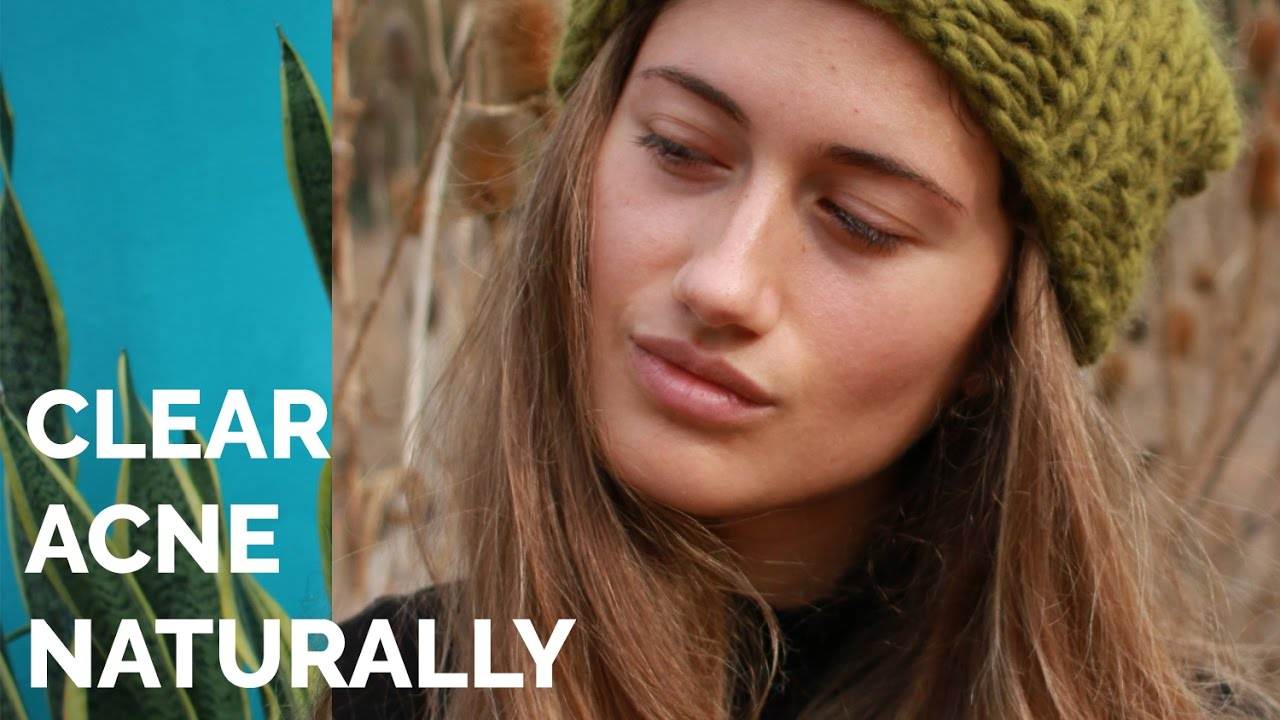 Get Flawless Skin This Spring: A Complete Guide