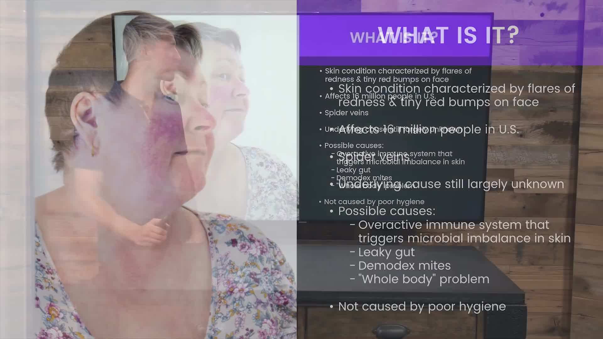 A woman applying gentle cleanser to her face