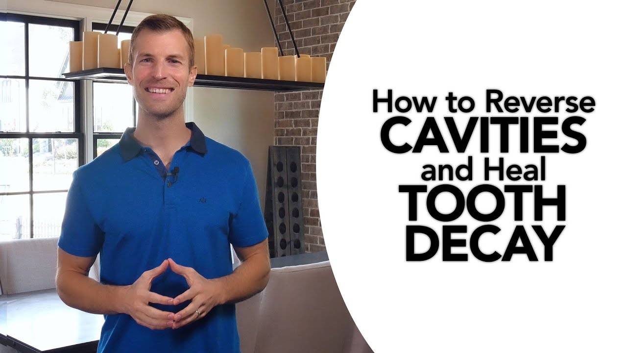 How to Naturally Treat Cavities and Reverse Tooth Decay - The Ultimate Guide