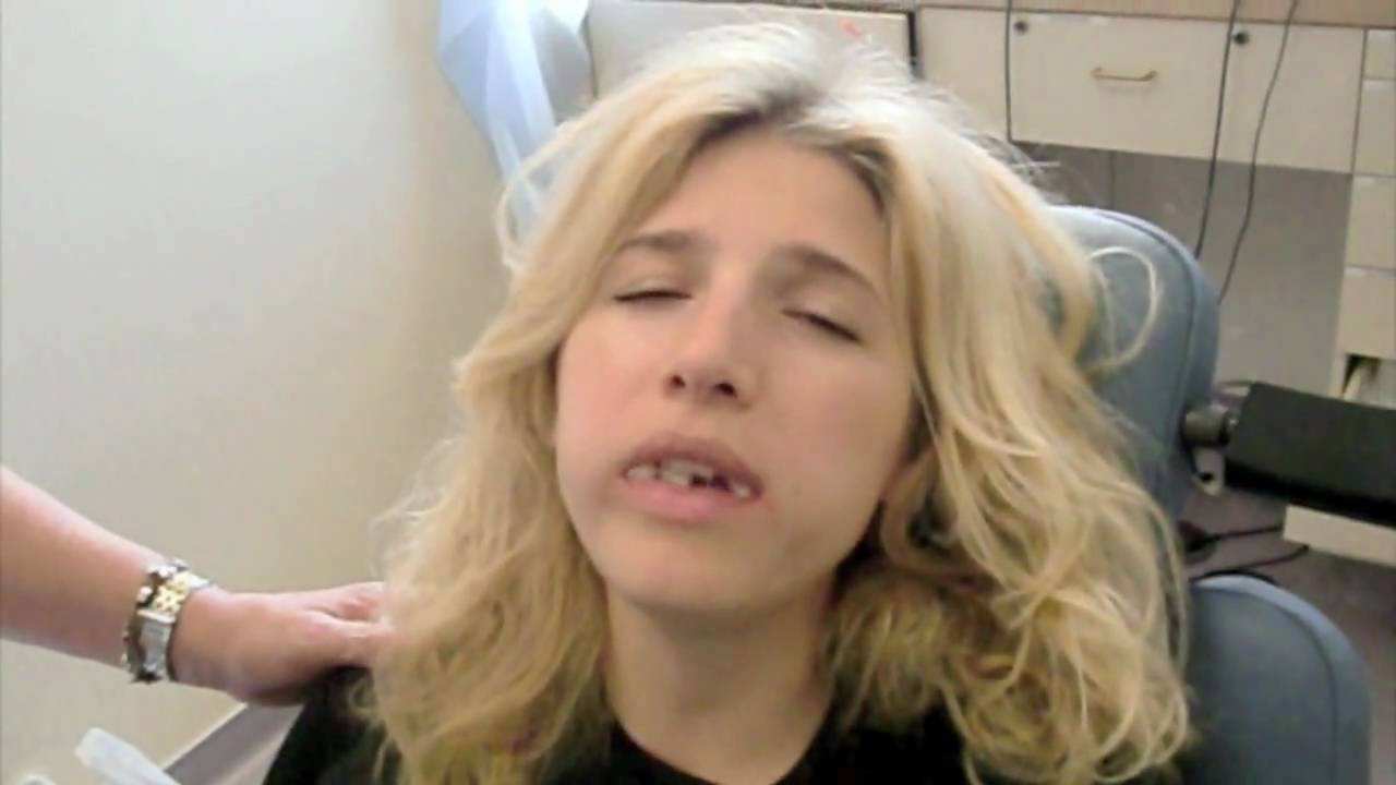 My Wisdom Teeth Removal Journey: Before and After Experience