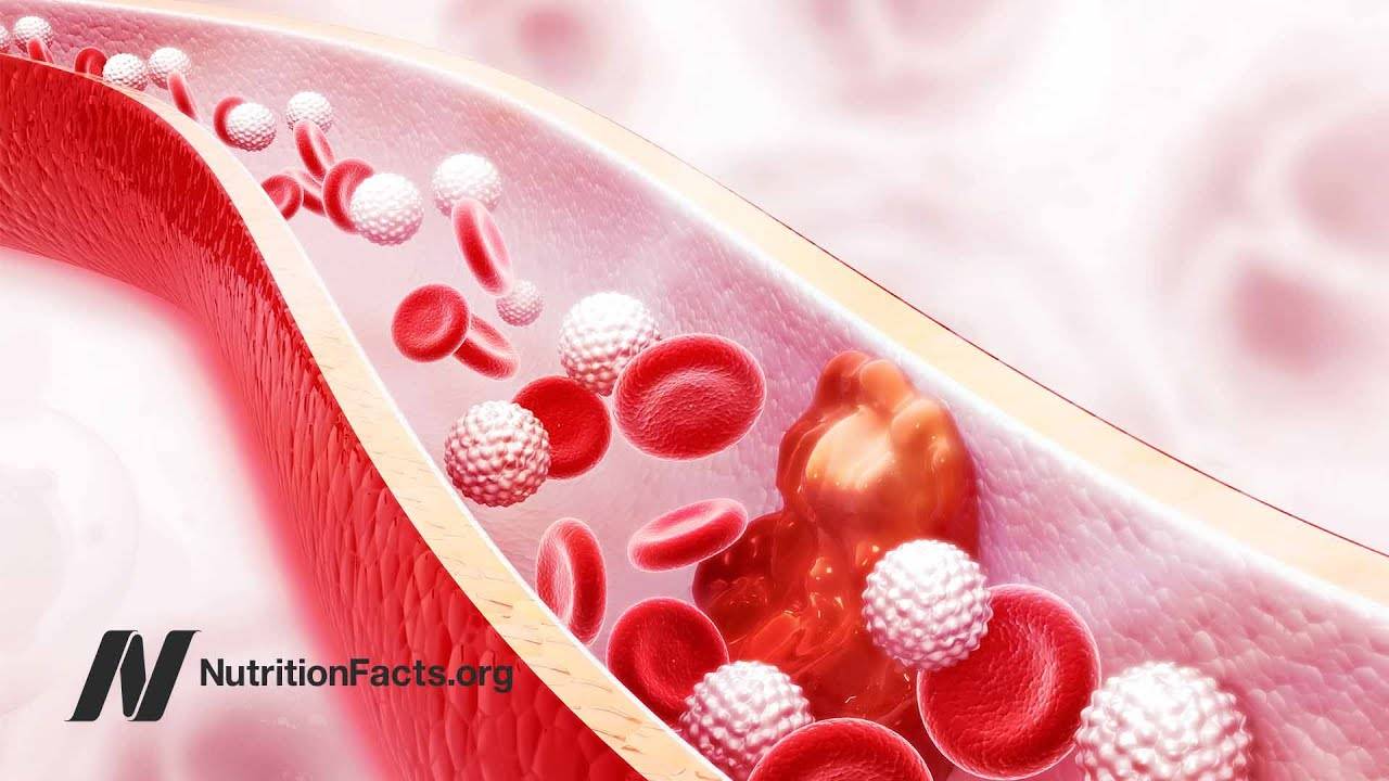 Are PCSK9 Inhibitors Safe and Effective for Lowering LDL Cholesterol Levels?